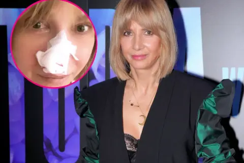 Grażyna Wolszczak po zabiegu. W okręgu zdjęcie z opatrunkiem na nosie, obok aktorka w eleganckiej kreacji.