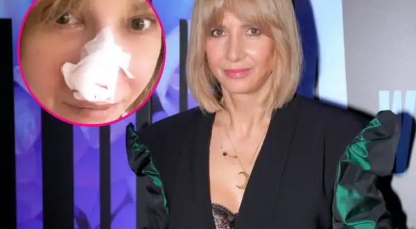 Grażyna Wolszczak po zabiegu. W okręgu zdjęcie z opatrunkiem na nosie, obok aktorka w eleganckiej kreacji.