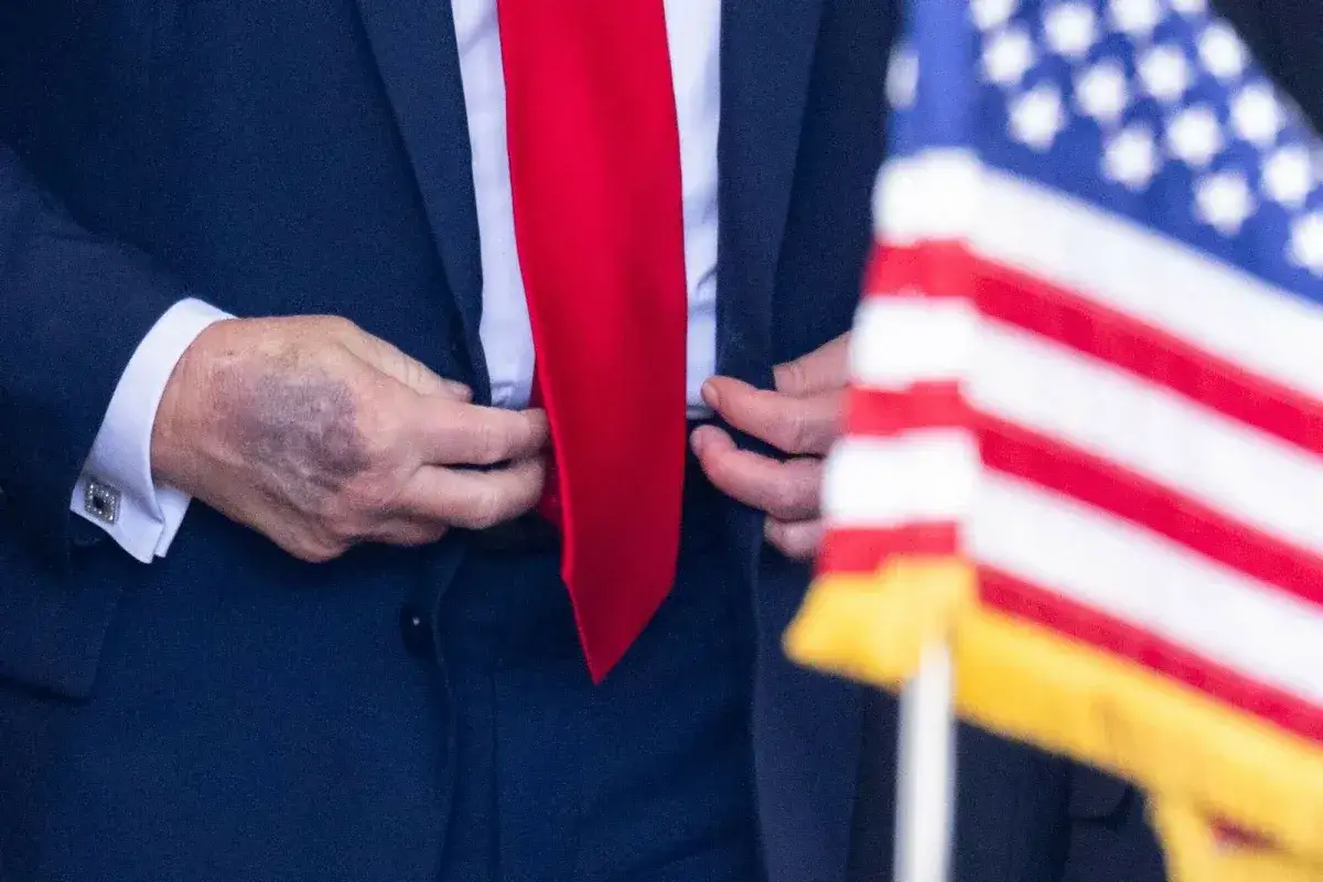 Dłoń Donalda Trumpa z widocznym siniakiem, ubrana w granatowy garnitur i czerwoną krawat. Obok amerykańska flaga.